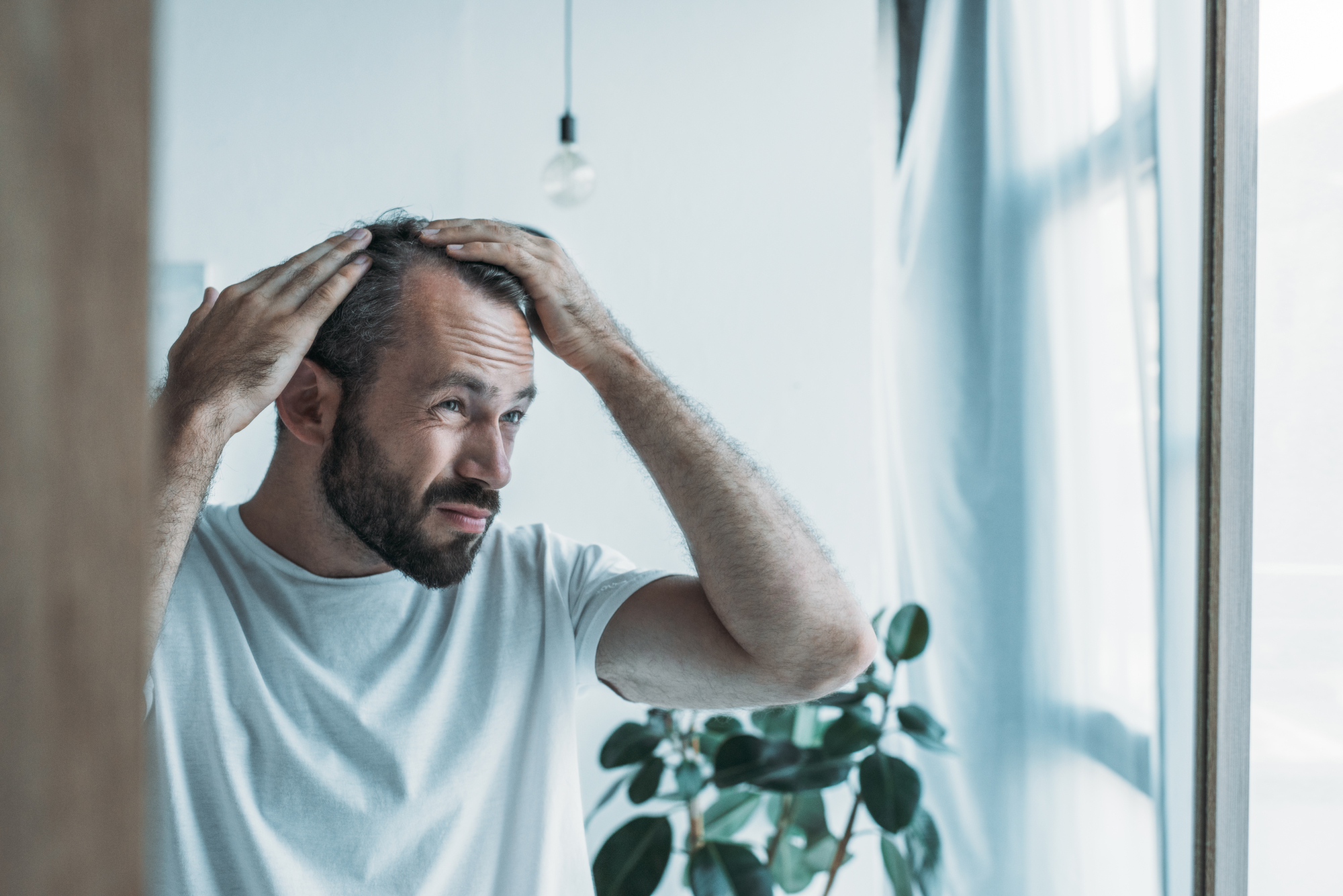 Read more about the article Common Misconceptions About Hair Transplants